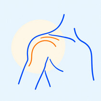 Shoulder stiffness and limited movement